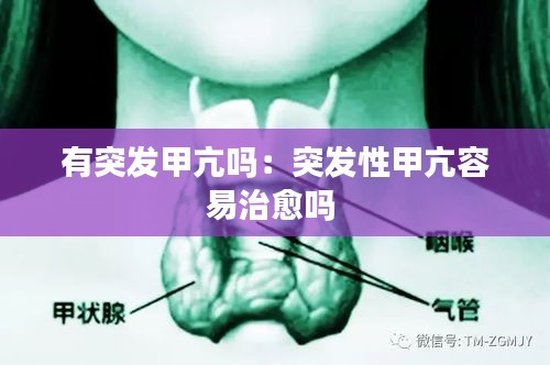 有突发甲亢吗：突发性甲亢容易治愈吗 