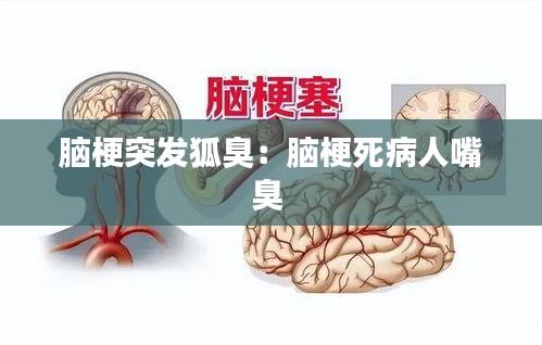 脑梗突发狐臭：脑梗死病人嘴臭 