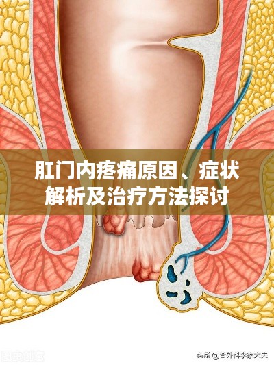 肛门内疼痛原因、症状解析及治疗方法探讨