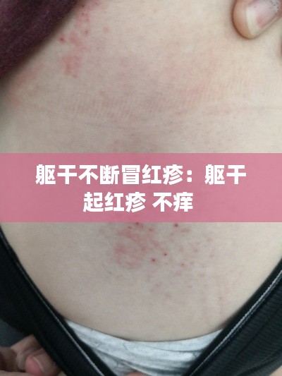 攀高接贵 第3页