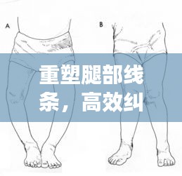重塑腿部线条，高效纠正腿型秘诀