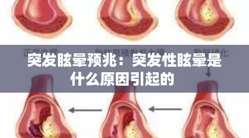 突发眩晕预兆：突发性眩晕是什么原因引起的 