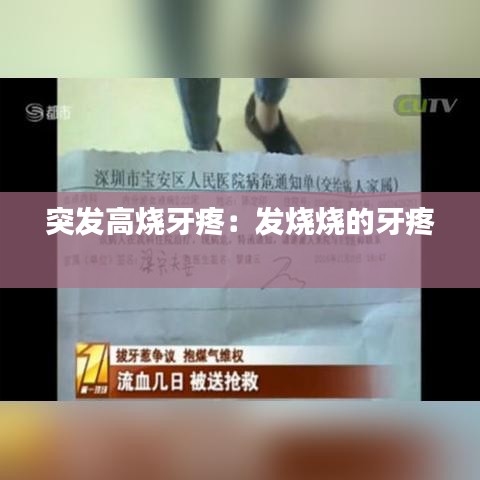 突发高烧牙疼：发烧烧的牙疼 