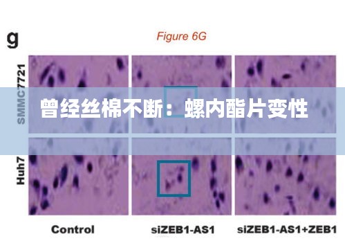 曾经丝棉不断：螺内酯片变性 