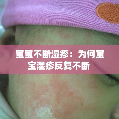 宝宝不断湿疹：为何宝宝湿疹反复不断 