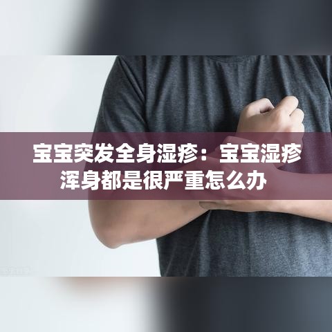 宝宝突发全身湿疹：宝宝湿疹浑身都是很严重怎么办 