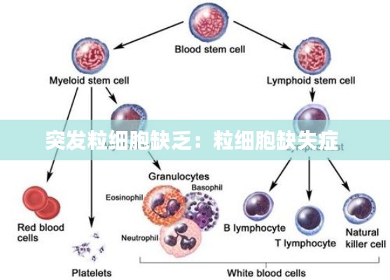 突发粒细胞缺乏：粒细胞缺失症 