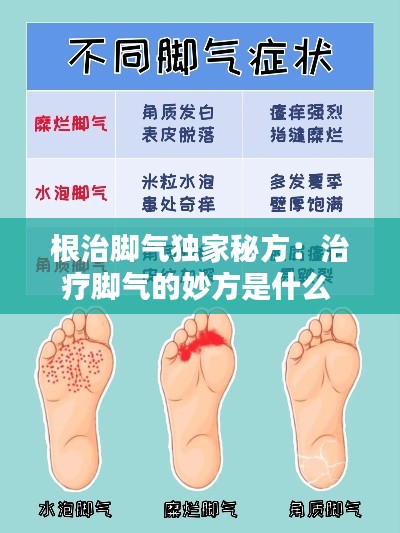 根治脚气独家秘方：治疗脚气的妙方是什么 