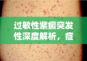 过敏性紫癜突发性深度解析，症状、原因与应对之策