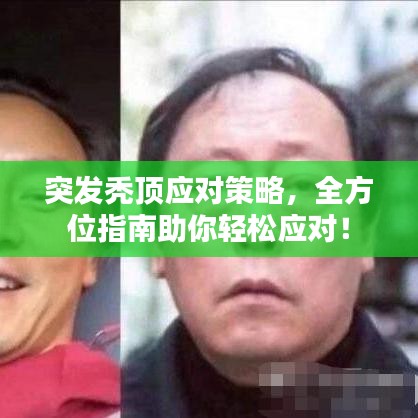 突发秃顶应对策略，全方位指南助你轻松应对！