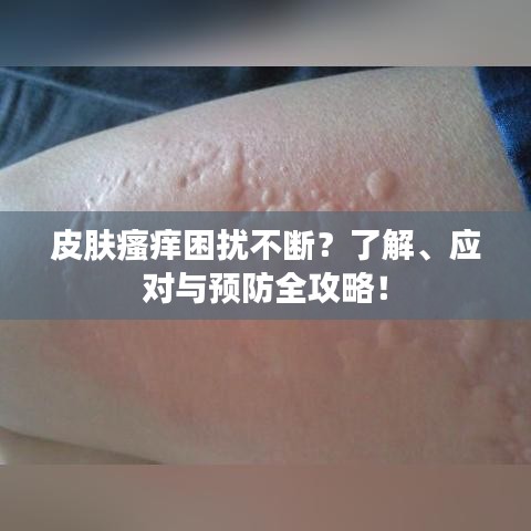 皮肤瘙痒困扰不断？了解、应对与预防全攻略！